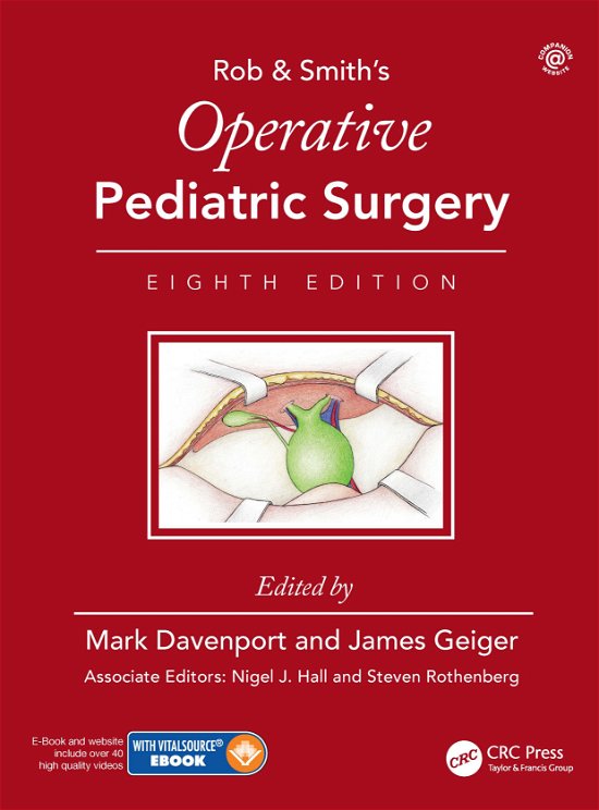 Cover for Mark Davenport · Operative Pediatric Surgery (Hardcover Book) (2021)