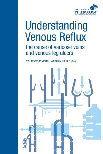 Understanding Venous Reflux the Cause of Varicose Veins and Venous Leg Ulcers - Mark S. Whiteley - Książki - Whiteley Publishing Ltd - 9781908586001 - 26 września 2011