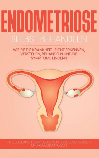 Cover for Anita Engelhardt · Endometriose selbst behandeln (Paperback Book) (2021)