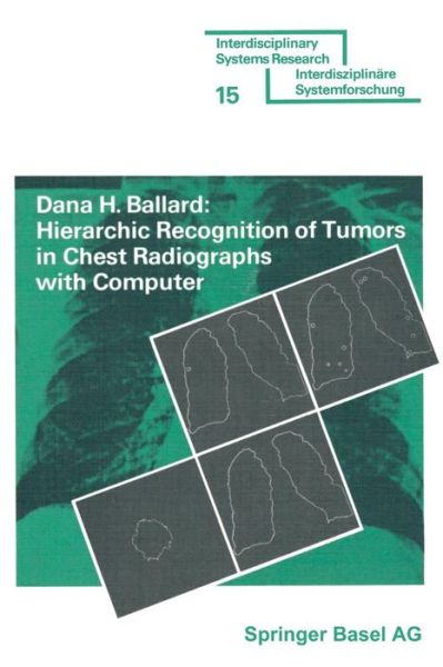 Cover for Ballard · Hierarchic Recognition of Tumors in Chest Radiographs with Computer - Interdisciplinary Systems Research (Paperback Book) (1976)