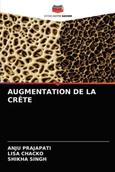 Cover for Anju Prajapati · Augmentation de la Crete (Paperback Book) (2021)