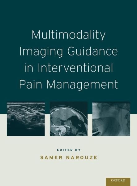 Cover for Multimodality Imaging Guidance in Interventional Pain Management (Gebundenes Buch) (2016)