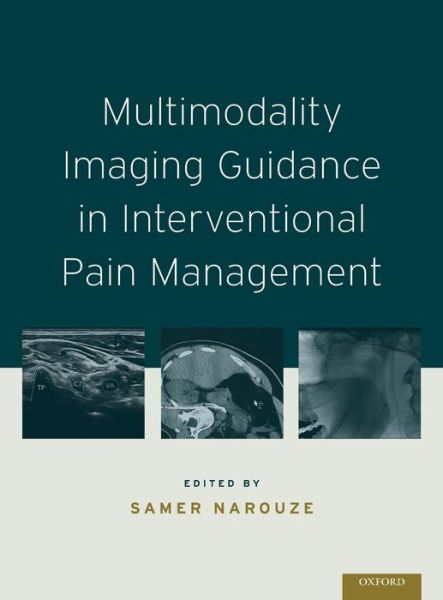 Cover for Multimodality Imaging Guidance in Interventional Pain Management (Inbunden Bok) (2016)