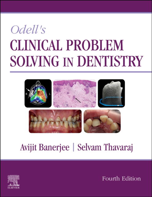 Cover for Avijit Banerjee · Odell's Clinical Problem Solving in Dentistry (Paperback Book) (2020)