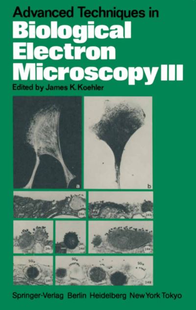 Advanced Techniques in Biological Electron Microscopy III - J K Koehler - Livros - Springer-Verlag Berlin and Heidelberg Gm - 9783540164005 - 1 de maio de 1986
