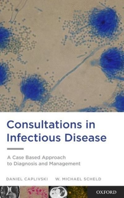 Cover for Caplivski, Daniel (Associate Professor of Medicine, Division of Infectious Diseases, Associate Professor of Medicine, Division of Infectious Diseases, Mount Sinai School of Medicine, New York, NY) · Consultations in Infectious Disease: A Case Based Approach to Diagnosis and Management (Taschenbuch) (2012)