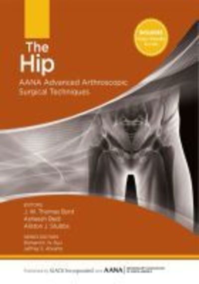 Cover for J. W. Thomas Byrd · The Hip: Aana Advanced Arthroscopic Surgical Techniques (Hardcover Book) (2015)