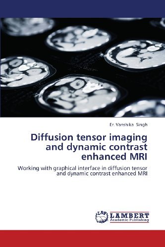 Diffusion Tensor Imaging and Dynamic Contrast Enhanced Mri: Working with Graphical Interface in Diffusion Tensor and Dynamic Contrast Enhanced Mri - Er. Vanshika Singh - Livros - LAP LAMBERT Academic Publishing - 9783659341007 - 11 de fevereiro de 2013