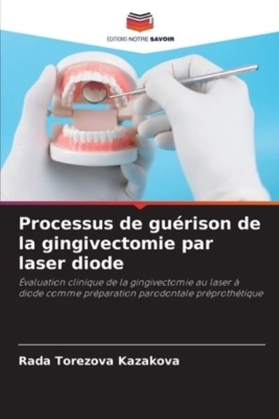 Cover for Rada Torezova Kazakova · Processus de guerison de la gingivectomie par laser diode (Pocketbok) (2021)