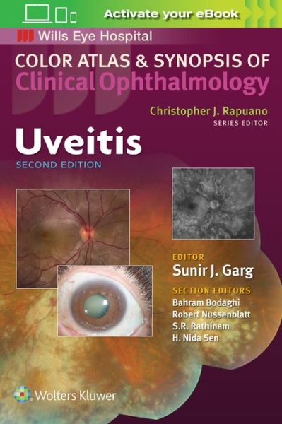 Cover for Sunir J. Garg · Uveitis - Color Atlas &amp; Synopsis of Clinical Ophthalmology (Paperback Book) (2018)