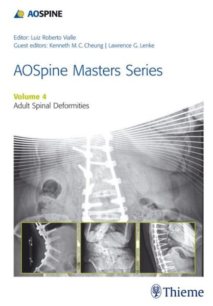 AOSpine Master Series. Adult Spinal Deformities - Luiz Roberto Gomes Vialle - Kirjat - Thieme Medical Publishers - 9781626231009 - maanantai 8. kesäkuuta 2015