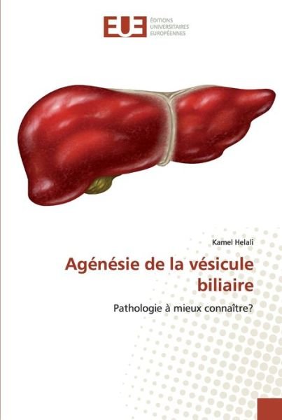 Cover for Helali · Agénésie de la vésicule biliaire (Book) (2020)