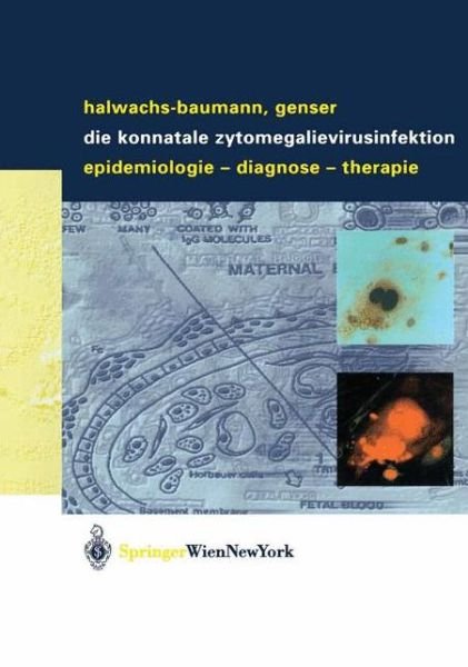 Gabriele Halwachs-Baumann · Die Konnatale Zytomegalievirusinfektion: Epidemiologie - Diagnose - Therapie (Paperback Bog) [2003 edition] (2003)