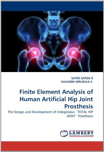 Cover for Kulkarni Mrudula S. · Finite Element Analysis of Human Artificial Hip Joint Prosthesis: the Design and Development of Indeginious 'total Hip Joint' Prosthesis (Paperback Bog) (2018)