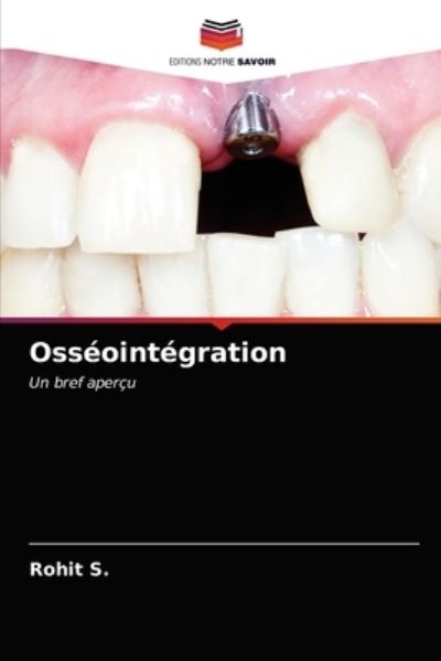 Cover for Rohit S · Osseointegration (Paperback Book) (2021)