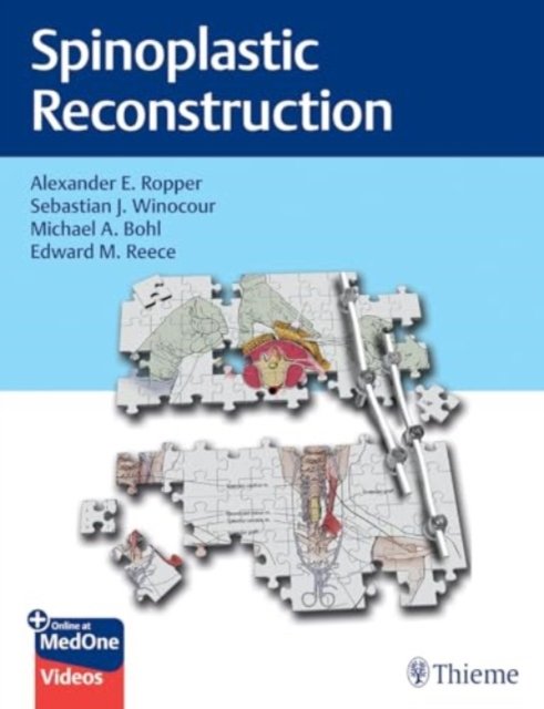 Cover for Alexander Ropper · Spinoplastic Reconstruction (N/A) (2024)