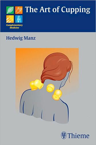 The Art of Cupping - Hedwig Manz - Bøger - Thieme Publishing Group - 9783131486011 - 10. september 2008