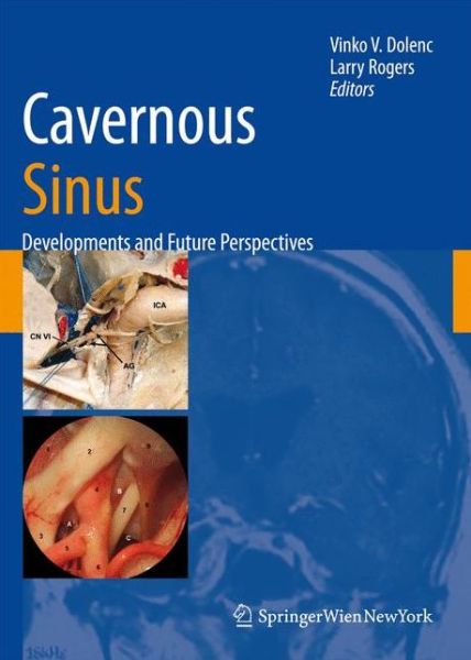 Cover for Cavernous Sinus: Developments and Future Perspectives (Paperback Book) [1st Ed. Softcover of Orig. Ed. 2009 edition] (2010)