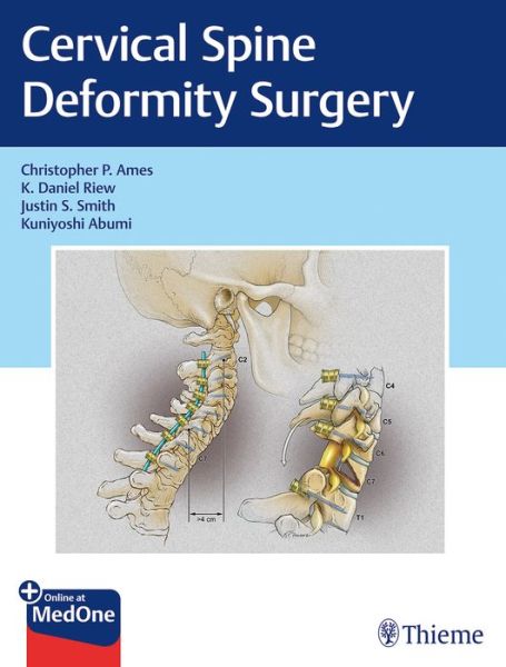 Cervical Spine Deformity Surgery - Christopher P. Ames - Bøger - Thieme Medical Publishers Inc - 9781626239012 - 23. oktober 2019