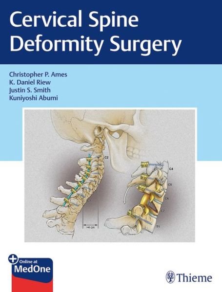 Cervical Spine Deformity Surgery - Christopher P. Ames - Livres - Thieme Medical Publishers Inc - 9781626239012 - 23 octobre 2019