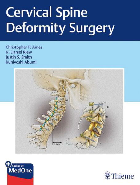 Cover for Christopher P. Ames · Cervical Spine Deformity Surgery (Buch) (2019)