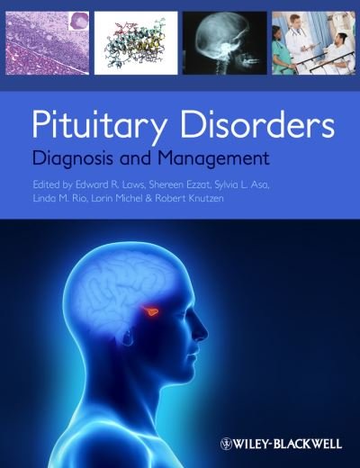 Pituitary Disorders: Diagnosis and Management - ER Laws - Books - John Wiley and Sons Ltd - 9780470672013 - April 19, 2013
