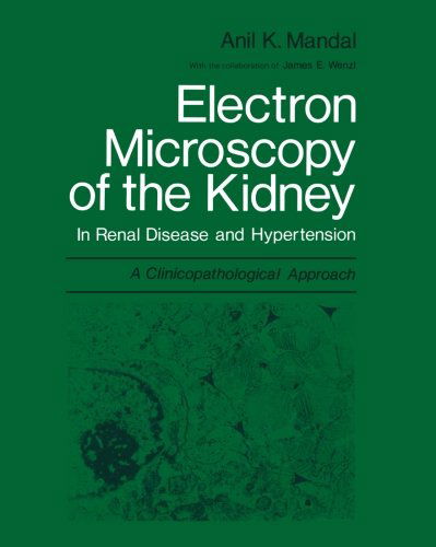 Cover for Anil K. Mandal · Electron Microscopy of the Kidney: In Renal Disease and Hypertension: A Clinicopathological Approach (Paperback Book) [Softcover reprint of the original 1st ed. 1979 edition] (2012)