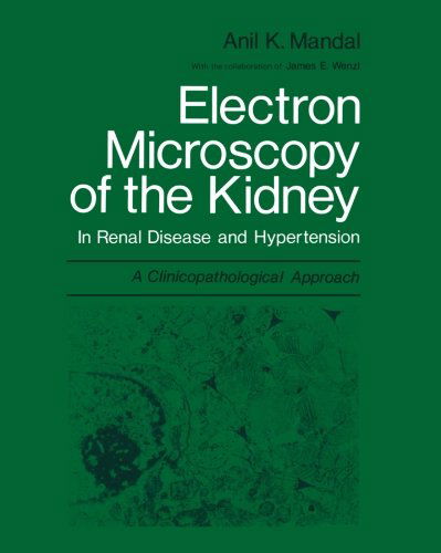 Cover for Anil K. Mandal · Electron Microscopy of the Kidney: In Renal Disease and Hypertension: A Clinicopathological Approach (Taschenbuch) [Softcover reprint of the original 1st ed. 1979 edition] (2012)