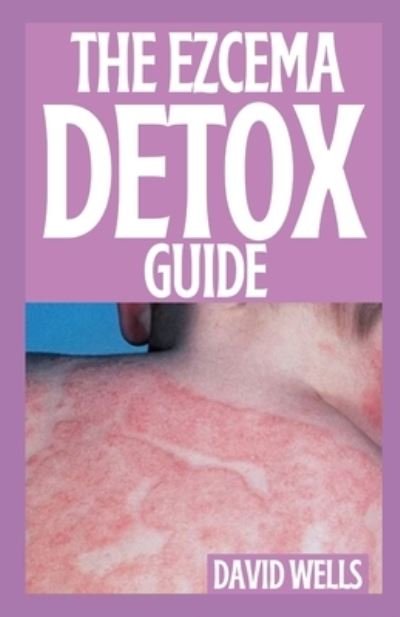Cover for David Wells · The Ezcema Detox Guide: How to Stop and Prevent The Itch of Eczema Through Diet and Nutrition (Paperback Book) (2021)