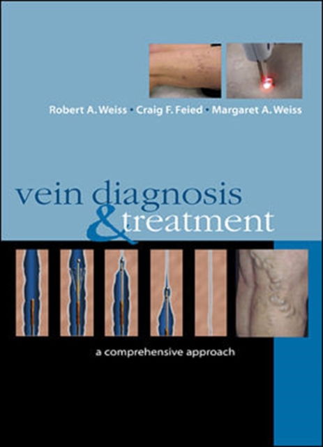 Cover for Robert Weiss · Vein Diagnosis &amp; Treatment: A Comprehensive Approach (Hardcover Book) [Ed edition] (2000)