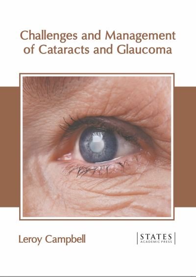 Cover for Leroy Campbell · Challenges and Management of Cataracts and Glaucoma (Hardcover Book) (2022)