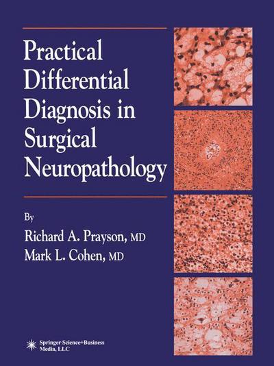 Cover for Richard A. Prayson · Practical Differential Diagnosis in Surgical Neuropathology (Paperback Book) [Softcover reprint of hardcover 1st ed. 2000 edition] (2010)