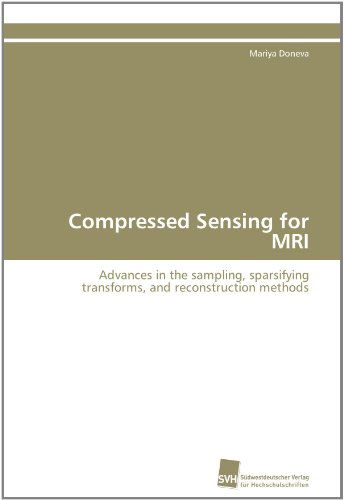 Compressed Sensing for Mri: Advances in the Sampling, Sparsifying Transforms, and Reconstruction Methods - Mariya Doneva - Books - Südwestdeutscher Verlag für Hochschulsch - 9783838111018 - August 1, 2011