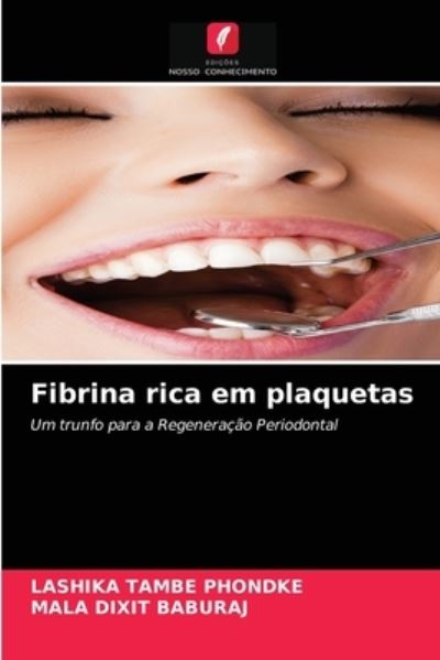 Cover for Lashika Tambe Phondke · Fibrina rica em plaquetas (Paperback Book) (2021)