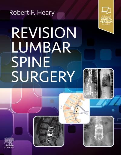 Cover for Robert F. Heary · Revision Lumbar Spine Surgery (Gebundenes Buch) (2021)