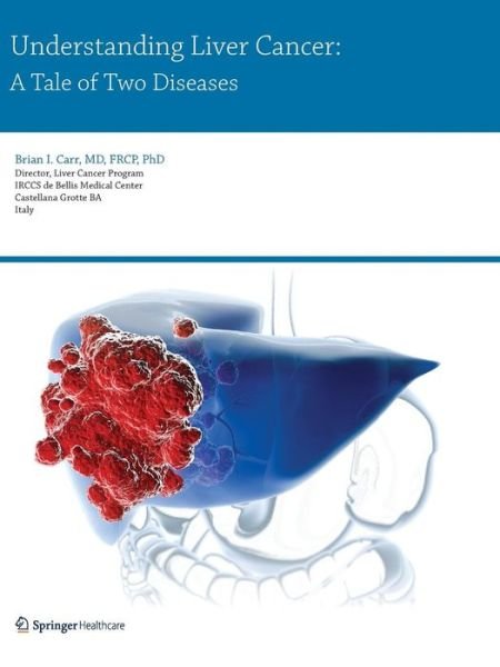 Cover for Brian I. Carr · Understanding Liver Cancer: A Tale of Two Diseases (Paperback Book) [2014 edition] (2014)