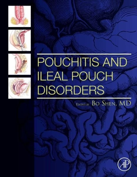 Pouchitis and Ileal Pouch Disorders: A Multidisciplinary Approach for Diagnosis and Management - Bo Shen - Bøker - Elsevier Science Publishing Co Inc - 9780128094020 - 7. november 2018