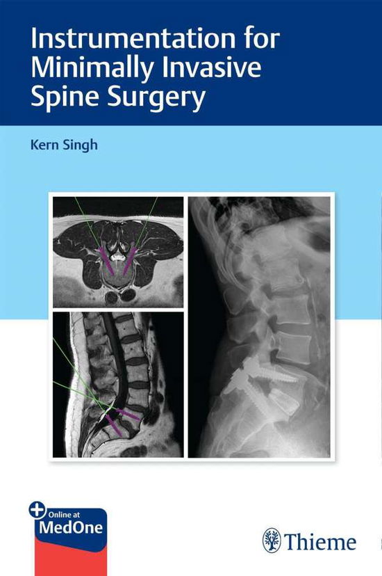 Cover for Kern Singh · Instrumentation for Minimally Invasive Spine Surgery (Book) (2021)