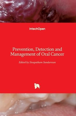 Cover for Sivapatham Sundaresan · Prevention, Detection and Management of Oral Cancer (Hardcover Book) (2019)