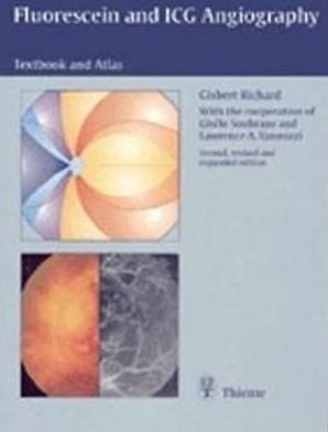 Fluorescein and ICG Angiography: Textbook and Atlas - Gisbert Richard - Livros - Thieme Medical Publishers - 9783137419020 - 23 de abril de 1998