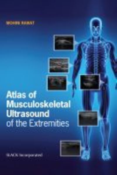 Cover for Mohini Rawat · Atlas of Musculoskeletal Ultrasound of the Extremities (Paperback Book) (2020)