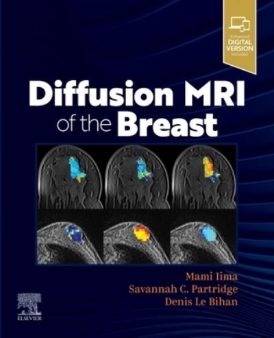 Cover for Mami Iima · Diffusion MRI of the Breast (Taschenbuch) (2022)