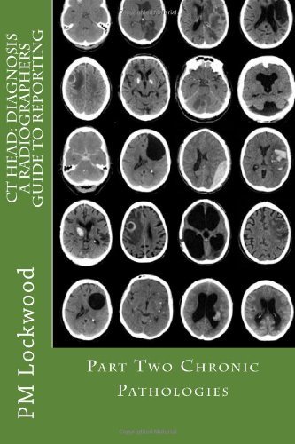 Cover for P M Lockwood · Ct Head: Diagnosis a Radiographers Guide to Reporting Part 2 Chronic Pathologies (Paperback Book) (2012)