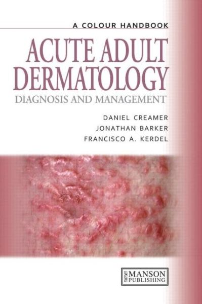 Cover for Creamer, Daniel (King’s College Hospital, London, UK) · Acute Adult Dermatology: Diagnosis and Management: A Colour Handbook - Medical Color Handbook Series (Paperback Book) (2011)