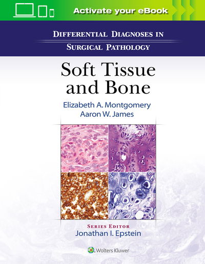 Cover for Elizabeth A. Montgomery · Differential Diagnoses in Surgical Pathology: Soft Tissue and Bone (Hardcover Book) (2020)