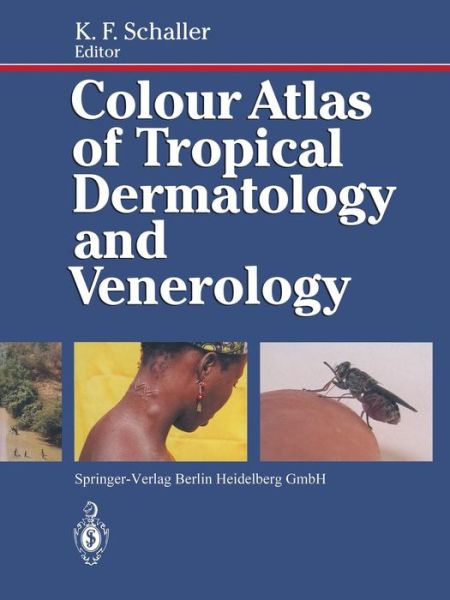 Cover for F F Weyer · Colour Atlas of Tropical Dermatology and Venerology (Paperback Bog) [Softcover reprint of the original 1st ed. 1994 edition] (2014)