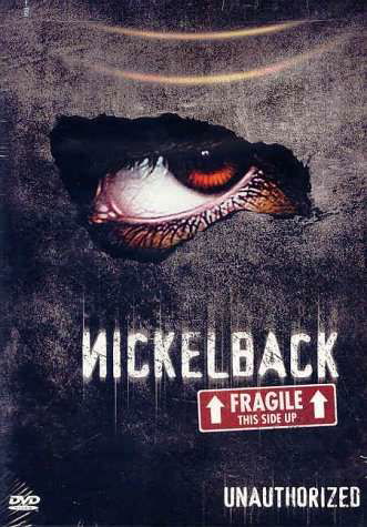 Unauthorized: Fragile Sid - Nickelback - Music - MVD - 0692865513025 - April 29, 2013