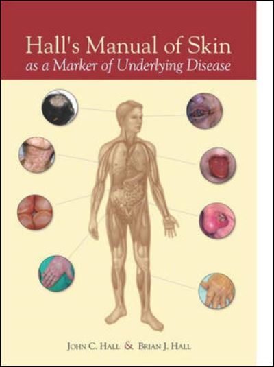 Hall's Manual of Skin as a Marker of Underlying Disease - John Hall - Books - PMPH-USA Limited - 9781607951025 - October 16, 2010