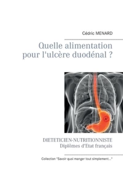 Cover for Cedric Menard · Quelle alimentation pour l'ulcere duodenal ? (Pocketbok) (2021)