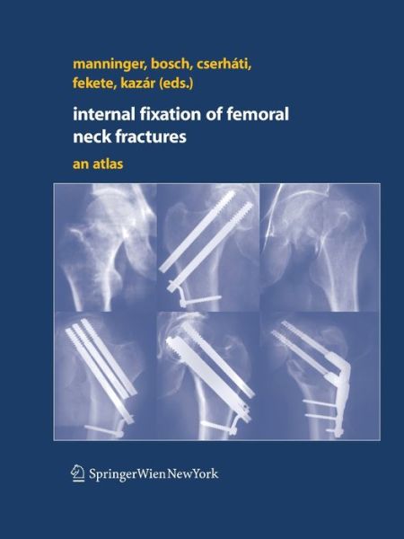 Cover for Internal fixation of femoral neck fractures: An Atlas (Paperback Book) [Softcover reprint of the original 1st ed. 2007 edition] (2016)